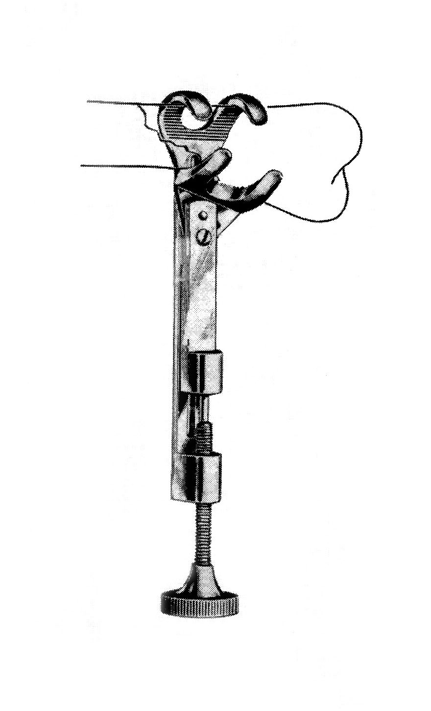 KEMİK TUTMA KLEMPİ 19 CM